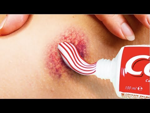 25 ایمنی HACKS که دارد کاملا درخشان